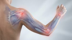 Заболевания сухожилий